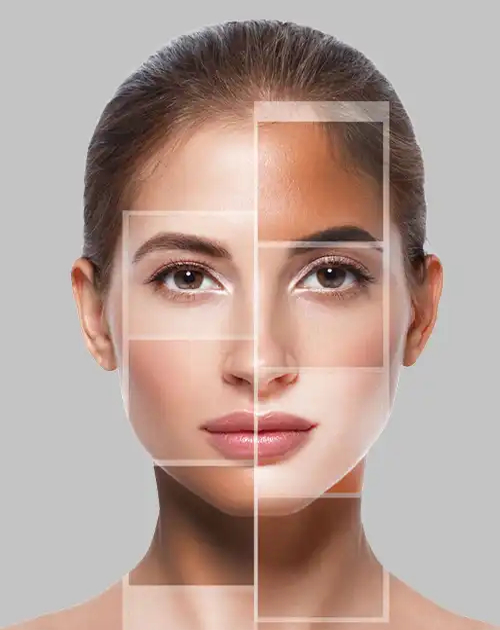 Skin Whitening Treatment